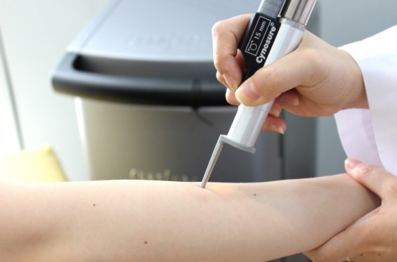 좋은 레이저제모의 5가지 원칙!